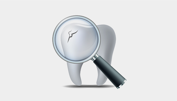 拡大視野下で精密な治療 低侵襲な歯科治療を提供 -マイクロスコープ・拡大鏡の活用-