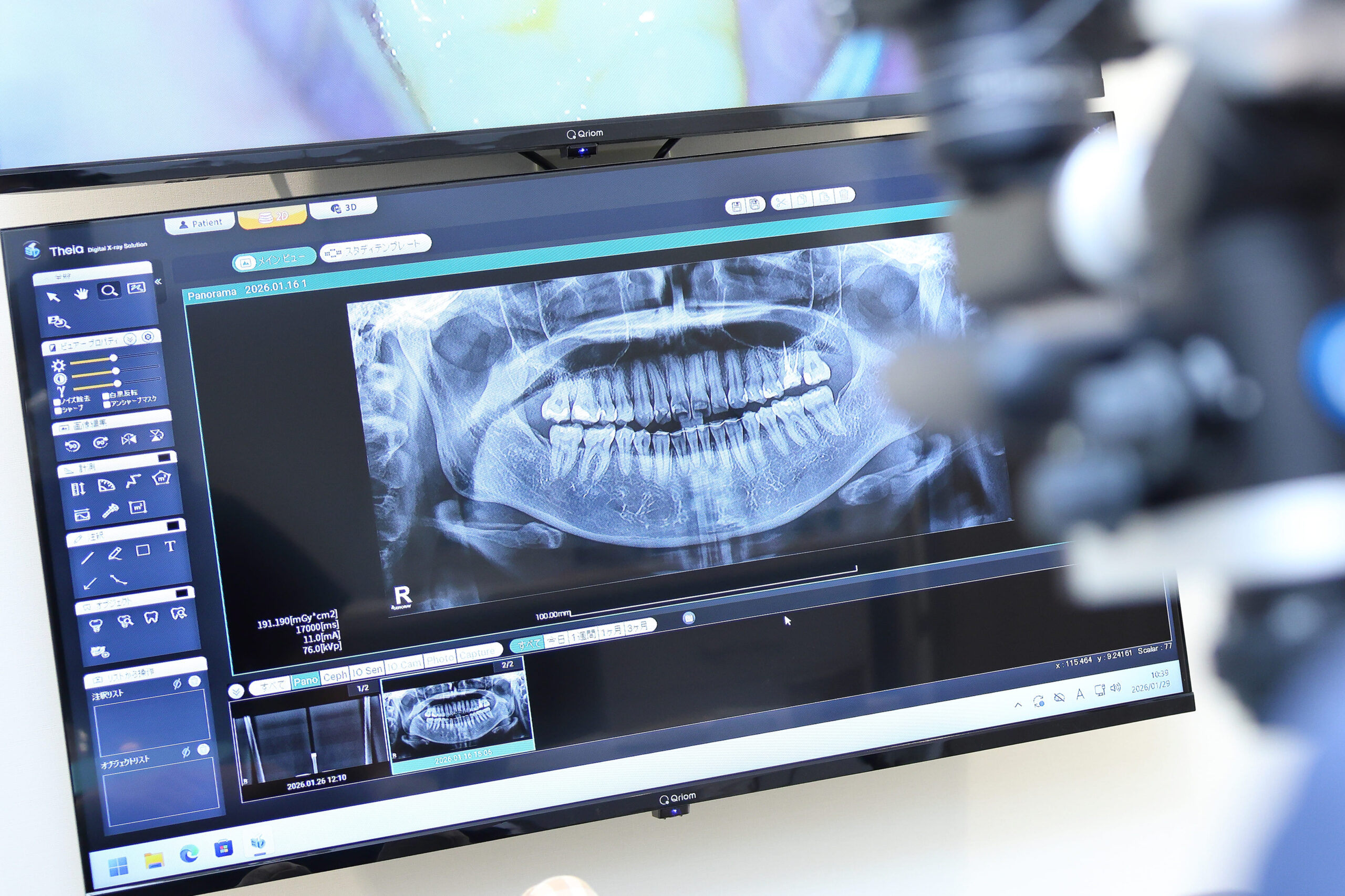 モニターに口腔内画像を映し出す
「可視化された歯科治療」